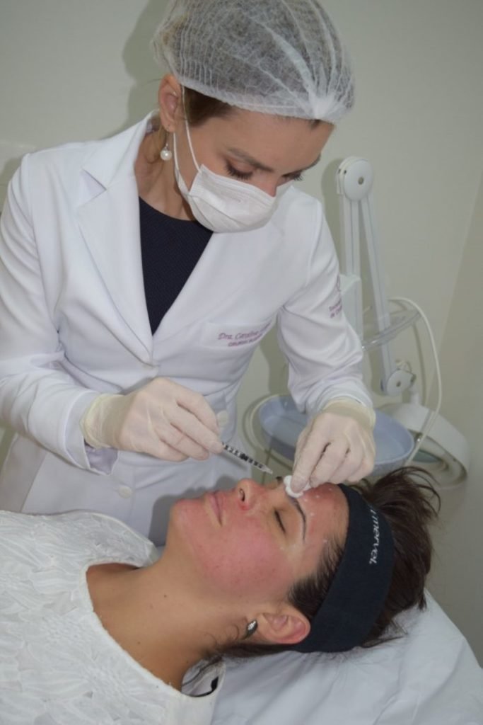 Carolina Schafer realiza microbotox