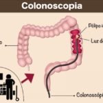 colonoscopia-exame-indicado-para-identificar-cancer-colorretal